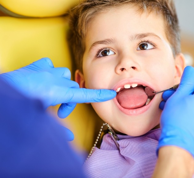 Dentist examining child's smile for thumb sucking damage