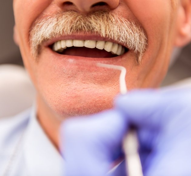 Man receiving a deep cleaning for gum disease
