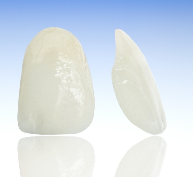 Metal free dental restorations prior to placement