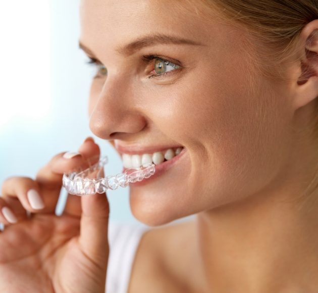 Woman placing an Invisalign clear braces tray