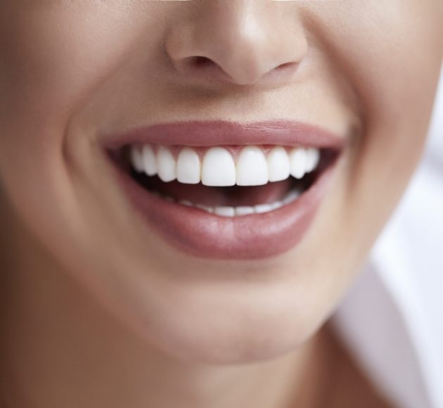 Smile restored with porcelain dental crowns