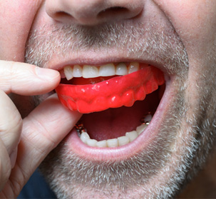 a person wearing an athletic mouthguard