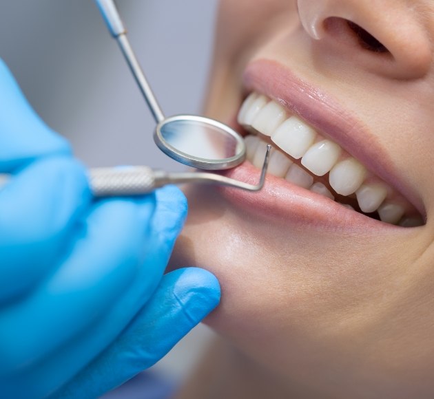 Dentist performing scaling and root planing deep cleaning for gum disease