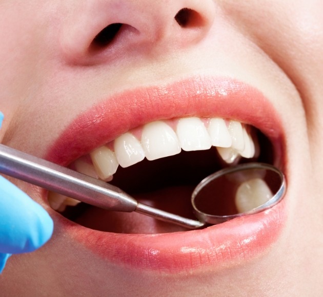 Dentist examining smile after tooth colored filling restorative dentistry