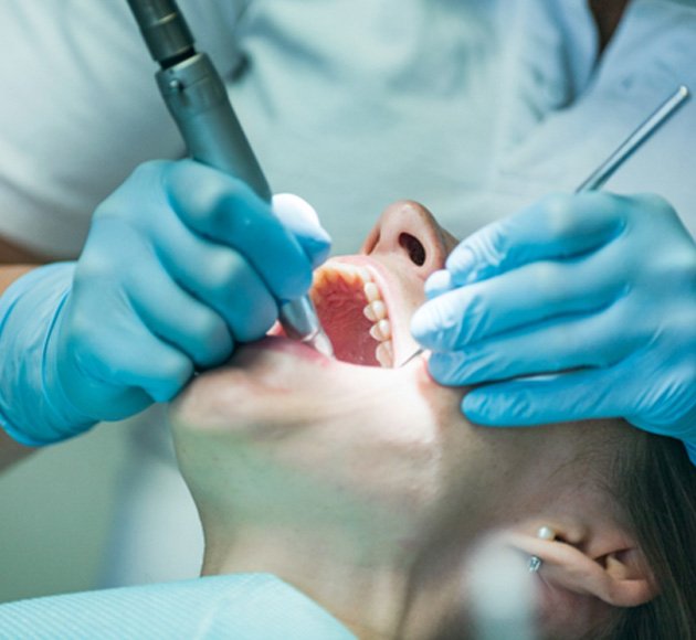 woman getting a tooth-colored filling 
