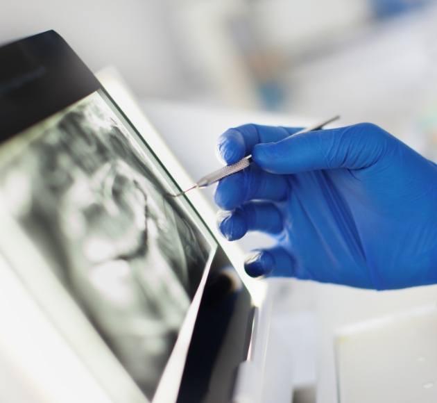 Dentist examining panoramic dental x-rays