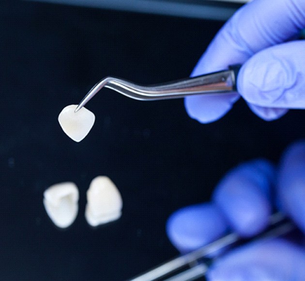 Veneers in dental lab