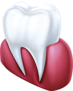 Getting gum disease therapy in Natik can reverse bad gum health. 